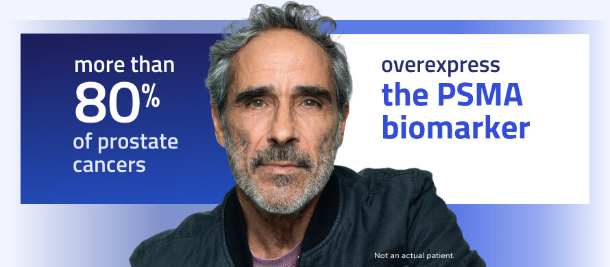 more than 80% of prostate cancers overexpress the PSMA biomarker
