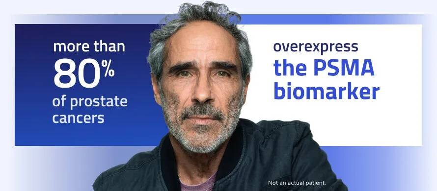 more than 80% of prostate cancers overexpress the PSMA biomarker